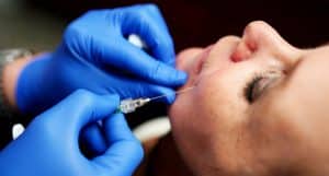 fullface behandeling