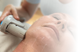 ultherapy